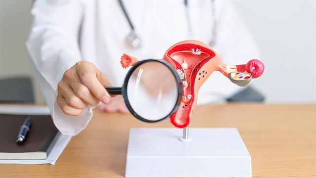 Πώς συνδέεται η καθιστική ζωή με τα ινομυώματα [μελέτη]