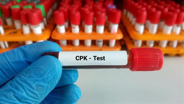 CPK : Σε ποιες περιπτώσεις βρίσκεται αυξημένη και σε ποιες ελαττωμένη