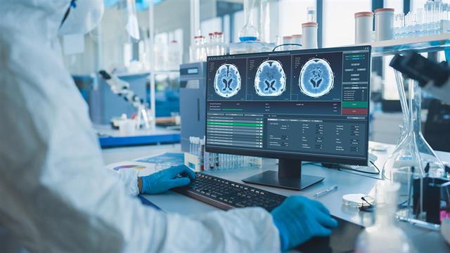 Η διακρανιακή διέγερση με συνεχές ρεύμα βελτιώνει τη μνήμη στη νόσο Αλτσχάιμερ