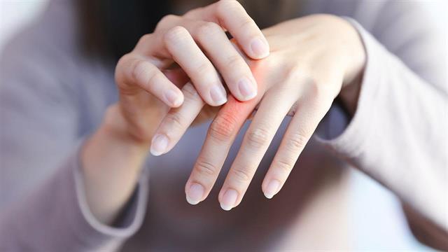 Ορμονικές αλλαγές είναι πιθανόν να προκαλούν ρευματοειδή αρθρίτιδα στις  γυναίκες [μελέτη]