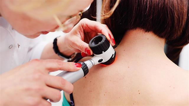 Ποιοι ιοί ευθύνονται για καρκίνο του δέρματος