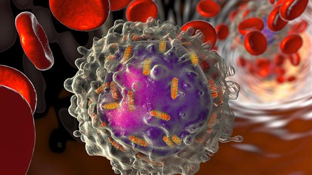 Νέες θεραπείες για τη χρόνια λεμφοκυτταρική λευχαιμία