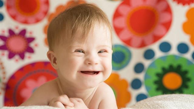 Εντοπίστηκε γονίδιο που συνδέεται με τα καρδιακά ελαττώματα στο σύνδρομο Down