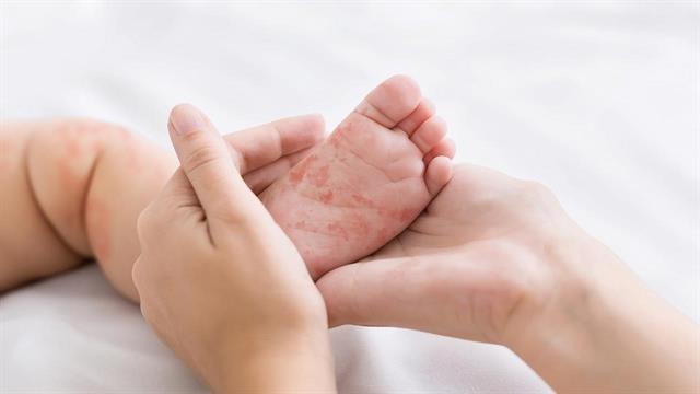 Η ιλαρά μάς ξαναθυμάται - 7 βήματα για να βάλουμε φραγμό