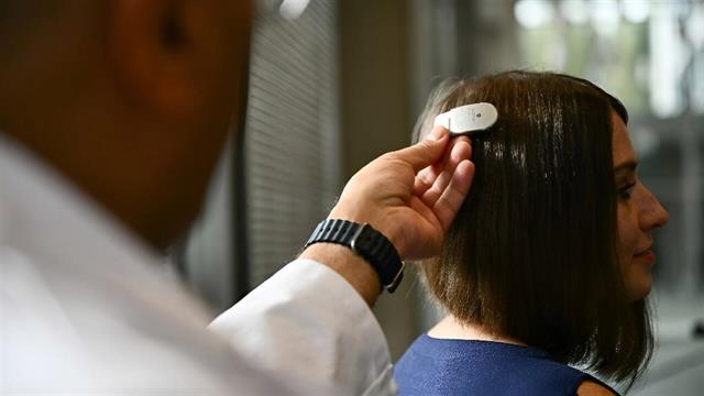 Εμφύτευμα στον εγκέφαλο αντιμετωπίζει για πρώτη φορά επιληψία και ιδεοψυχαναγκαστική διαταραχή