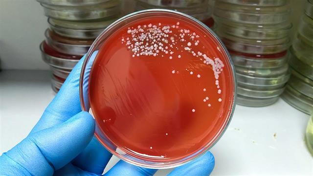 ΕΟΔΥ: 23 θάνατοι από στρεπτόκοκκο στην Ελλάδα - Οι 11 αφορούν παιδιά