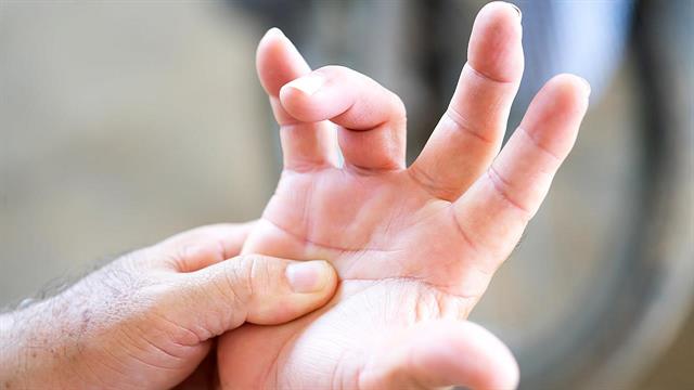 Εκτινασσόμενος δάκτυλος: 10 αλήθειες για μια από τις συχνότερες νόσους των χεριών