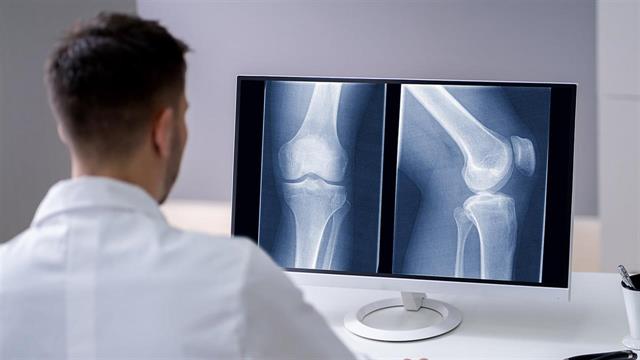 Χαράτσι 1 έως 3 ευρώ και στις διαγνωστικές εξετάσεις - Τι εξετάζεται από το υπουργείο Υγείας