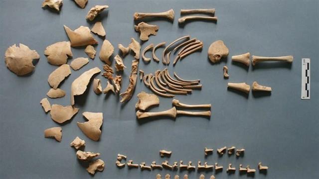 Εντοπίστηκε σύνδρομο Down σε παιδιά που έζησαν στην αρχαιότητα- Και στην Ελλάδα