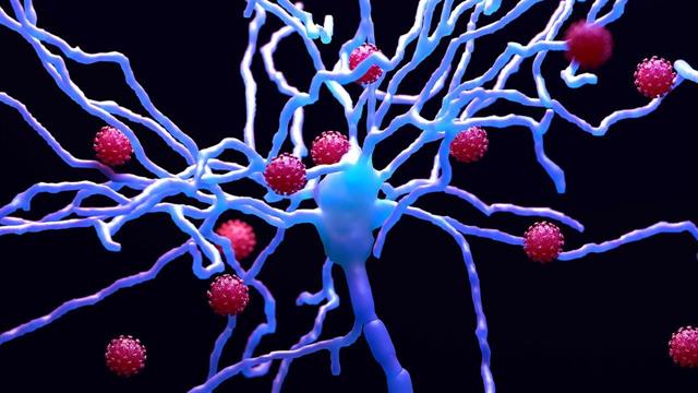 Εισήγηση ΕΜΑ για χορήγηση άδειας κυκλοφορίας σε νέο φάρμακο κατά της ALS