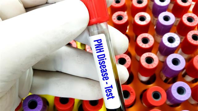 Πρώτη από του στόματος θεραπεία κατά της παροξυσμικής νυχτερινής αιμοσφαιρινουρίας