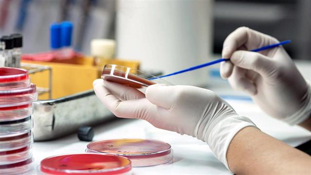 Στην Πάτρα κλιμάκιο του ΕΟΔΥ μετά το νέο κρούσμα μηνιγγίτιδας σε φοιτητή