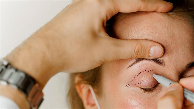 Βλεφαροπλαστική επέμβαση: Laser ή χειρουργείο;