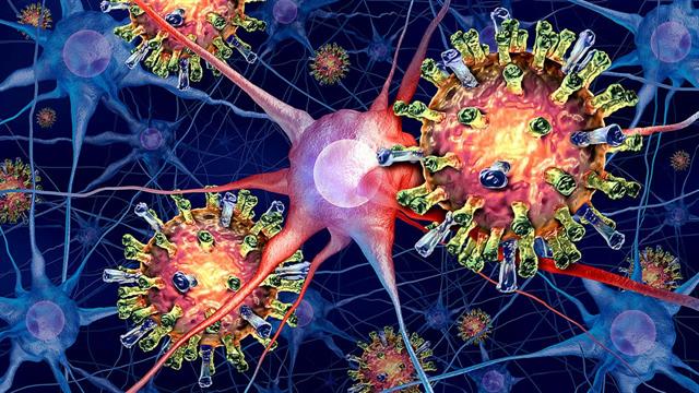 Οδηγίες CDC για διαχείριση κρουσμάτων μηνιγγίτιδας από μηνιγγιτιδόκοκκο