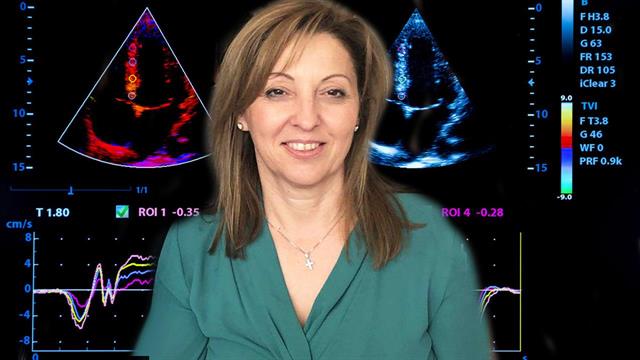 Το παραλήρημα ασθενών μετά από έμφραγμα επιδεινώνει την έκβασή τους