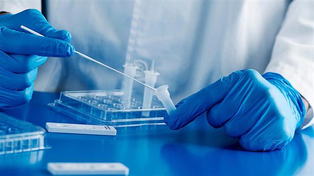 Νέο τεστ ούρων ανιχνεύει τον καρκίνο της κεφαλής και του τραχήλου