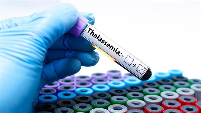 Αιμορροφιλία Α: Θετική γνωμοδότηση  για θεραπεία από την Επιτροπή Φαρμάκων για Ανθρώπινη Χρήση