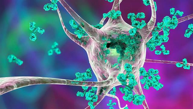 Συστηματική σκλήρυνση:  Ποσοστό 3% έχουν αυτοαντισώματα NOR90