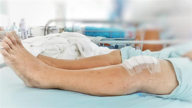 Αρθροσκόπηση γόνατος: Αντιμετωπίζει τον πόνο;