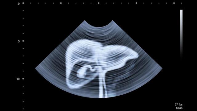 Πώς αντιδρά το συκώτι στη θέα της τροφής