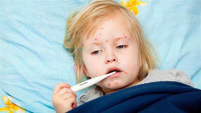 Ιλαρά: Γιατί παιδιά που γεννήθηκαν με καισαρική τομή χρειάζονται δυο δόσεις εμβολίου [μελέτη]