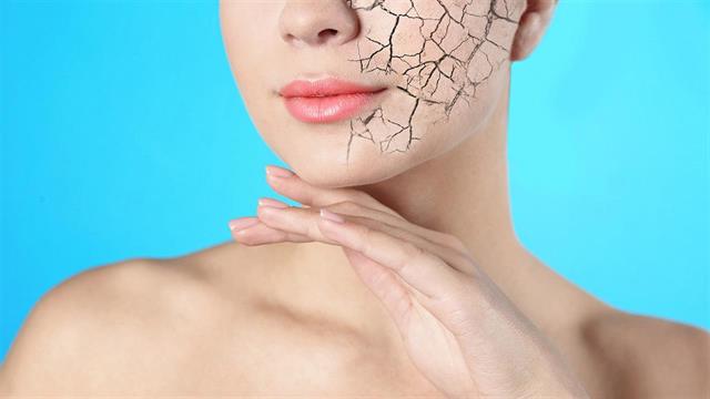 Συμβουλές για να αντιμετωπίσετε την ξηροδερμία