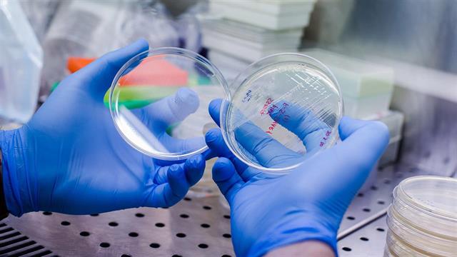 Πρώτη δοκιμή ανοσοθεραπείας με in-house παραγόμενα 3ης γενεάς CAR-T λεμφοκύτταρα