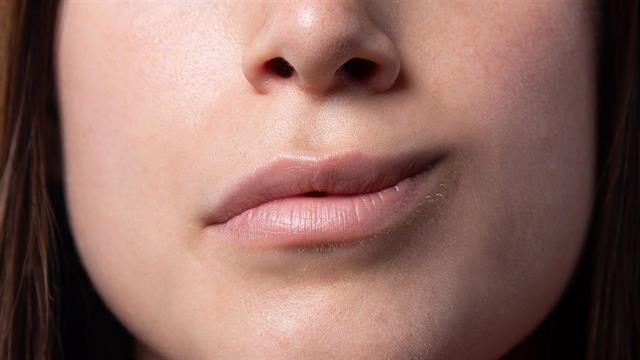 Παράλυση προσώπου: Γιατί συμβαίνει και πώς αντιμετωπίζεται