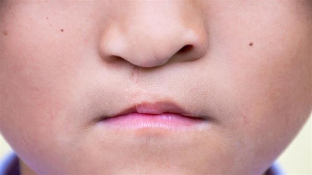 Κρανιοπροσωπικές διαφορές:  Τι είναι, πώς εκλαμβάνονται, που και πώς αντιμετωπίζονται