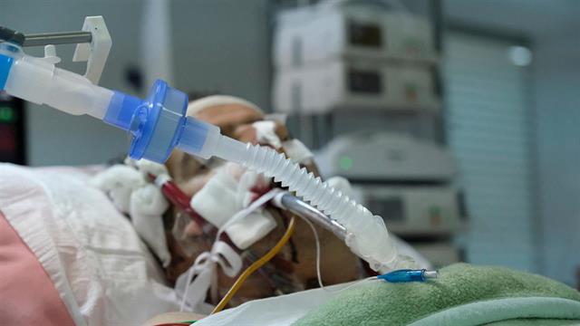 Αυστρία: μηνύσεις κατά της Philips για ελαττωματικούς αναπνευστήρες