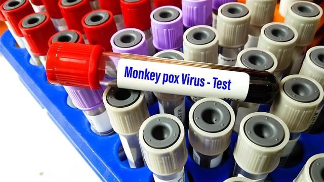 Δεύτερος θάνατος από mpox στη Νότια Αφρική σε μια εβδομάδα