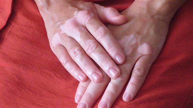 Η ρουξολιτινίμπη έφθασε στην Ελλάδα