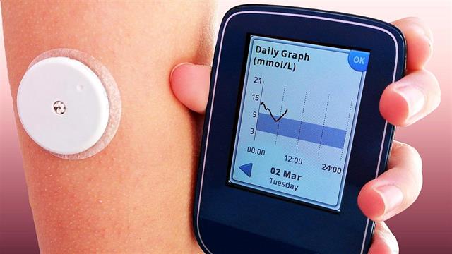 ΠΟΣΣΑΣΔΙΑ: Να αποζημιώνονται τα συστήματα καταγραφής γλυκόζης σε άτομα με διαβήτη τύπου 2