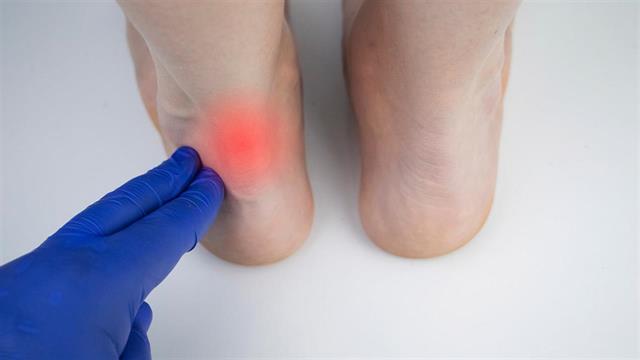 Μητέρα: Σπάνια αρθροσκοπική επέμβαση σε ασθενή με παραμελημένη ρήξη αχιλλείου και πολλαπλά συνοδά προβλήματα