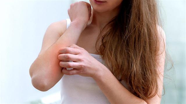 Ερευνα συνδέει την ψωρίαση με ιδεοψυχαναγκαστική διαταραχή