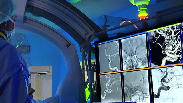 Siemens Healthineers και ο Παγκόσμιος Οργανισμός για τα Αγγειακά Εγκεφαλικά Επεισόδια (WSO) ενώνουν δυνάμεις