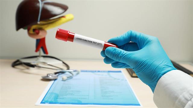 Απλή εξέταση αίματος εντοπίζει προχωρημένη ηπατική νόσο [μελέτη]