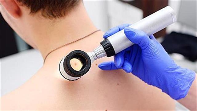 Δωρεάν έλεγχος σπίλων σε 4 ακριτικά νησιά υπό την αιγίδα της Δερματολογικής Εταιρείας