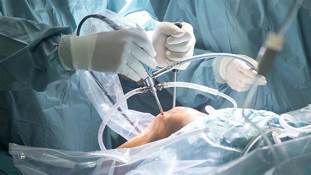 Αντιδρούν οι προμηθευτές ορθοπαιδικού υλικού στο αναδρομικό rebate προς το ΕΣΥ