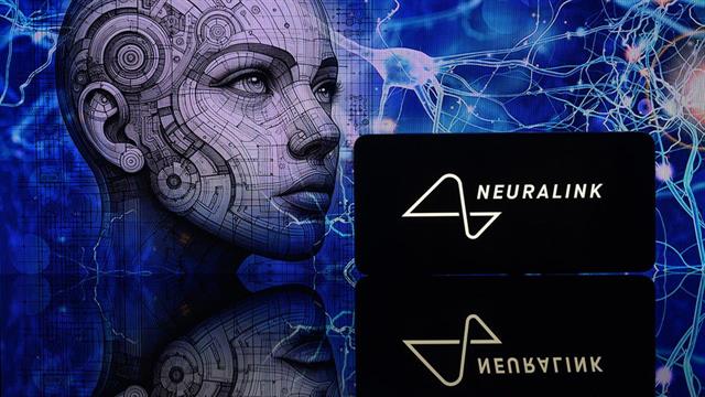 Επιτυχές το πρώτο εμφύτευμα τσιπ στον εγκέφαλο