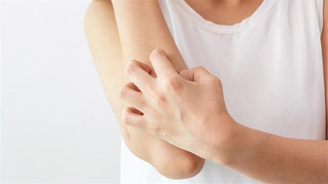 Είναι ξηροδερμία ή έκζεμα;