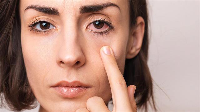 Γιατί είναι κόκκινα τα μάτια μου;