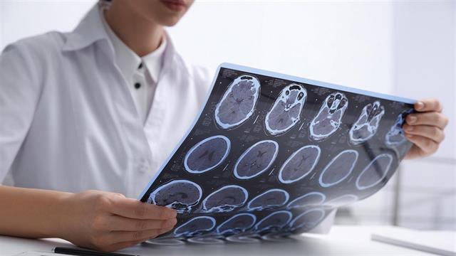 Εγκρίθηκε στην Ευρωπαϊκή Ένωση σκεύασμα για την  πολλαπλή σκλήρυνση