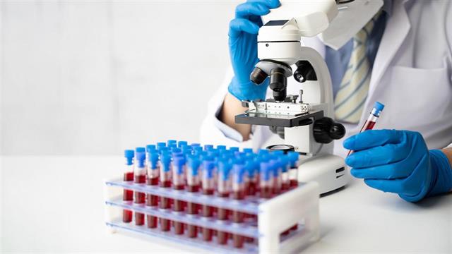 Εξέταση αίματος για τον καρκίνο παχέος εντέρου ενέκρινε ο FDA