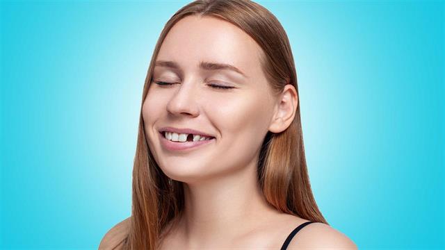 Η απώλεια δοντιών αυξάνει τον κίνδυνο θανάτου από καρδιαγγειακές νόσους [μελέτη]