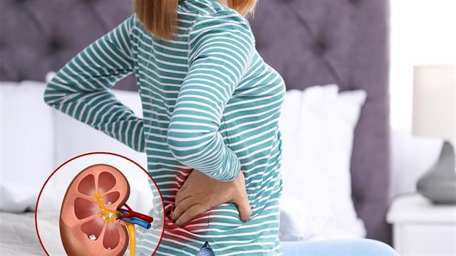 Πέτρες στα νεφρά: Ποια είναι τα συμπτώματα