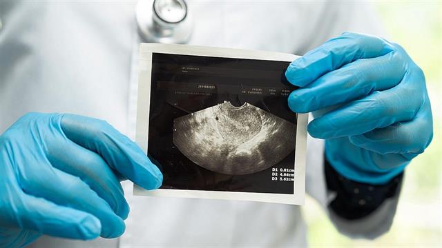 Γυναικεία γονιμότητα: Επηρεάζεται από τη ζέστη;