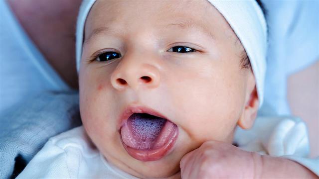 Τι κρύβουν οι επώδυνες στοματικές άφθες