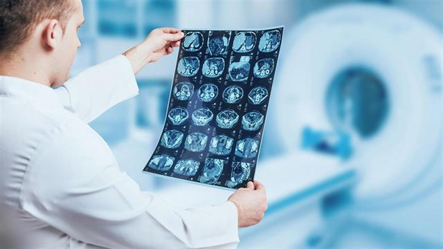 8 + 1 ερωτήσεις για την πολλαπλή σκλήρυνση