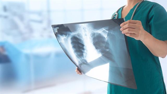 Πρόληψη καρκίνου του πνεύμονα